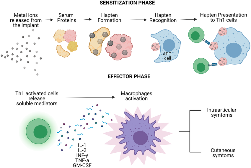 Visual breakdown of the sensitization and effector phases in Type IV hypersensitivity reactions, related to silicone or implant exposure.